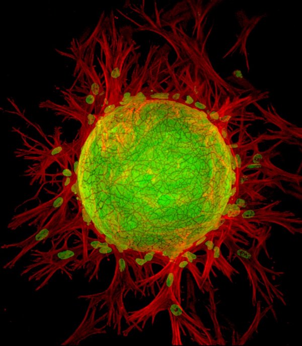 ������ ������ �������� Nikon Small World Photomicrography 2012